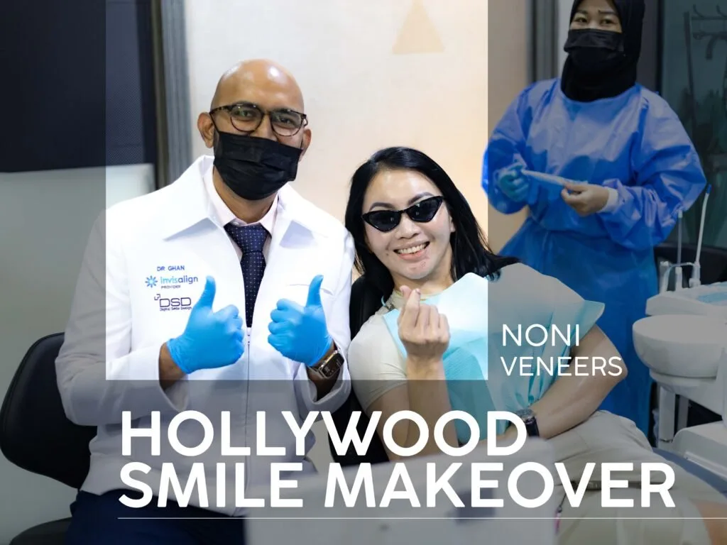 Noni — Hollywood Smile Veneers at Borneo Dental Centre