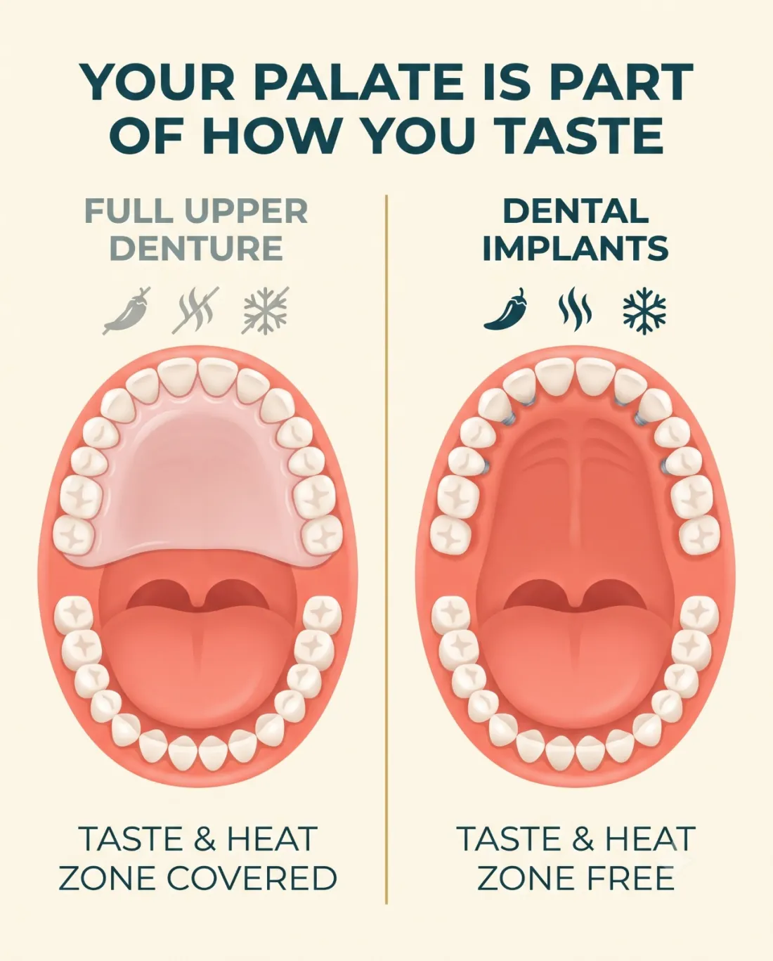 Full upper denture covering the palate taste and heat zone versus dental implants leaving the palate free