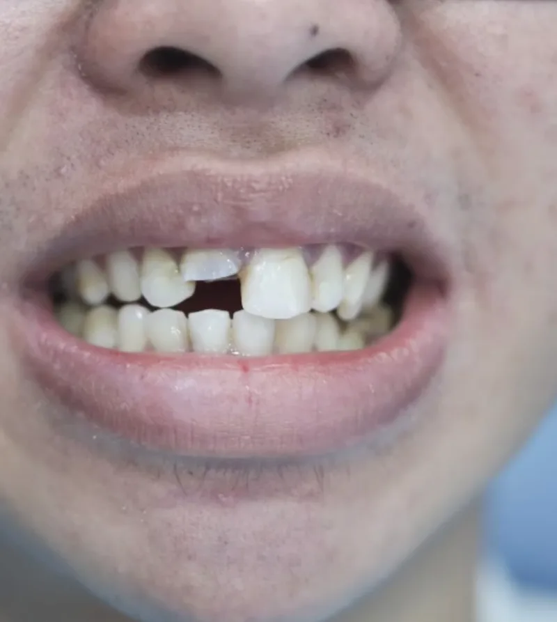 Rexcy Rozell — before